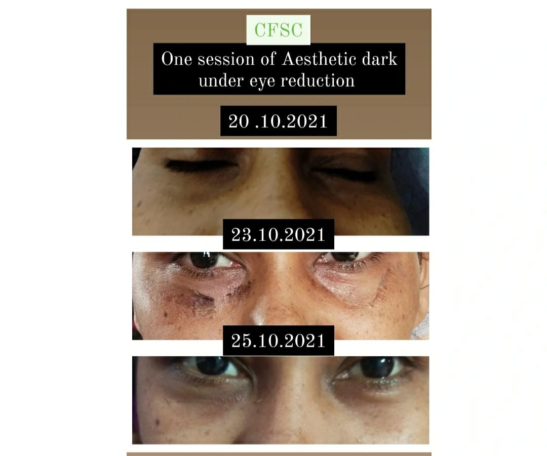 Before After Facial Treatment